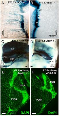 Spiral Ganglion Neuron Projection Development to the Hindbrain in Mice Lacking Peripheral and/or Central Target Differentiation